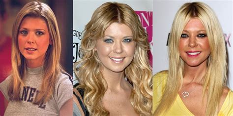 tara reid plastic surgery|Tara Reid Before and After Plastic Surgery: Boobs,。